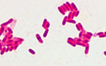 Methylobacterium rhodinum Gram stain