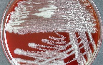 Mycobacterium chelonae (Mycobacteroides chelonae)  culture incubated with CO2