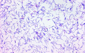 Mycobacterium fortuitum (Mycobacteroides fortuitum) Gram stain