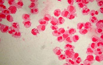 Neisseria meningitidis Gram stain
