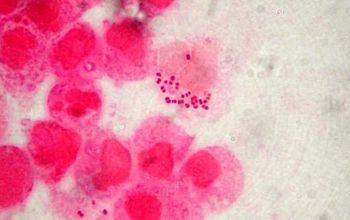 Neisseria meningitidis Gram stain