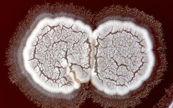 Nocardia astroides  culture incubated with CO2
