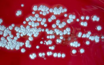 Nocardia brasiliensis  culture incubated with CO2