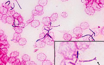 Nocardia brasiliensis Gram stain