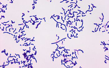 Nocardia farcinica Gram stain