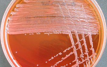 Ochrobactrum anthropi (Brucella anthropi) Mac Conkey Agar without salt 48h culture incubated with O2