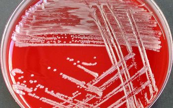 Oligella urethralis Blood Agar 48h culture incubated with O2