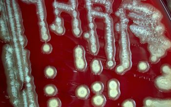 Paenibacillus pabuli Blood Agar 48h culture incubated with CO2
