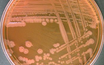 Proteus vulgaris Mac Conkey Agar without salt 48h culture incubated with O2