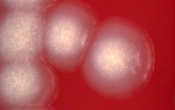 Providencia alcalifaciens Blood Agar 24h culture incubated with CO2