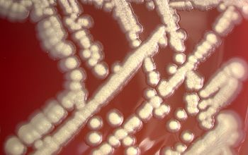 Providencia alcalifaciens Blood Agar 48h culture incubated with O2