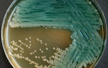 Pseudomonas aeruginosa  culture incubated with O2