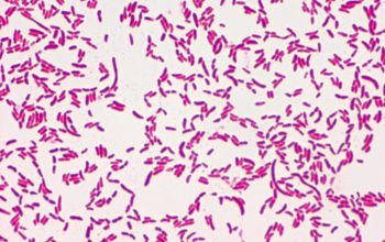 Pseudomonas fluorescens Gram stain