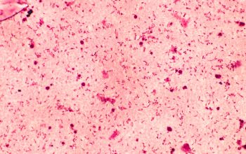 Rhizobium radiobacter (Agrobacterium radiobacter) Gram stain