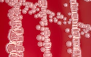 Rothia dentocariosa Blood Agar 48h culture incubated with CO2