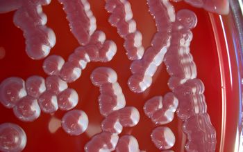 Serratia rubidaea Blood Agar 48h culture incubated with O2