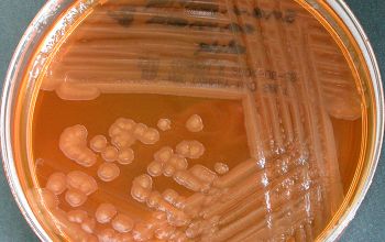 Shewanella putrefaciens Mac Conkey Agar without salt 48h culture incubated with O2