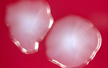 Shigella flexneri Blood Agar 48h culture incubated with O2
