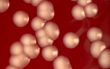 Sphingobacterium multivorum Blood Agar 48h culture incubated with O2