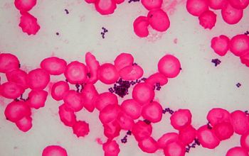 Staphylococcus aureus Gram stain