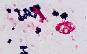 Staphylococcus aureus Gram stain