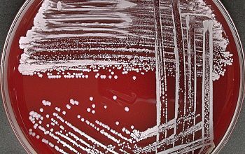 Staphylococcus auricularis Blood Agar 48h culture incubated with CO2