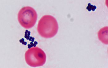 Staphylococcus auricularis Gram stain