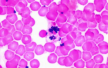 Staphylococcus capitis subsp capitis Gram stain