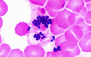 Staphylococcus capitis subsp capitis Gram stain