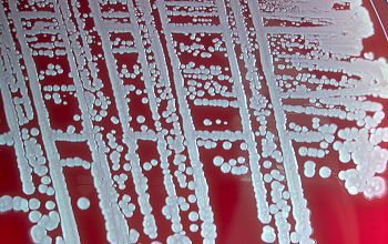 Staphylococcus capitis subsp capitis Blood Agar 48h culture incubated with CO2