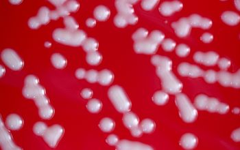Staphylococcus saprophyticus Blood Agar 24h culture incubated with CO2