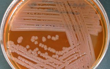 Stenotrophomonas maltophilia Blood Agar 48h culture incubated with O2