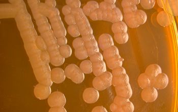 Stenotrophomonas maltophilia Blood Agar 48h culture incubated with O2
