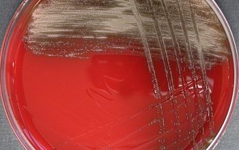 Streptococcus gordonii Blood Agar 24h culture incubated with CO2