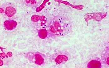 Streptococcus pneumoniae 