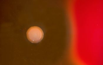 Streptococcus pyogenes Blood Agar 48h culture incubated with CO2