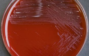 Treuperella pyogenes (Arcanobacterium pyogenes) Blood Agar 24h culture incubated with CO2