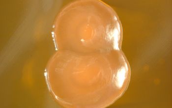 Vibrio cholerae Mac Conkey Agar without salt 48h culture incubated with O2