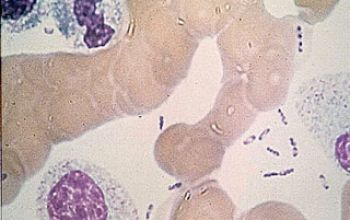 Yersinia pestis 