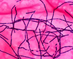 Gram staining
