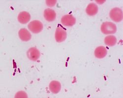 Dienes phenomenon test_P. mirabilis