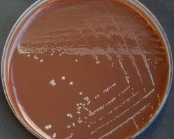 Granules_Aggregatibacter actinomycetemcomitans