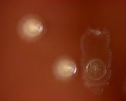 Granules_Aggregatibacter actinomycetemcomitans
