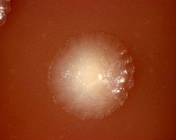 Granules_Aggregatibacter actinomycetemcomitans