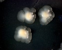 Granules_Aggregatibacter actinomycetemcomitans