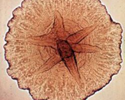 Granules_Aggregatibacter actinomycetemcomitans