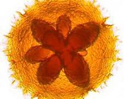Granules_Aggregatibacter actinomycetemcomitans