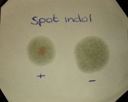 Indole test