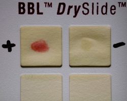 Nitrocefin DrySlide™